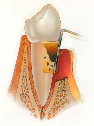 parodontologiya